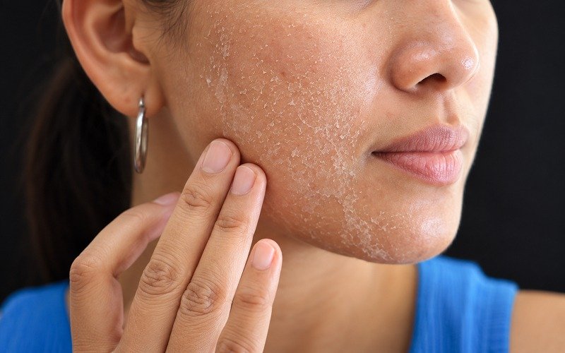 Makeup for Indian Skin dry skin
